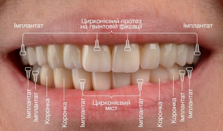 Біомеханіка та приживлюваність системи